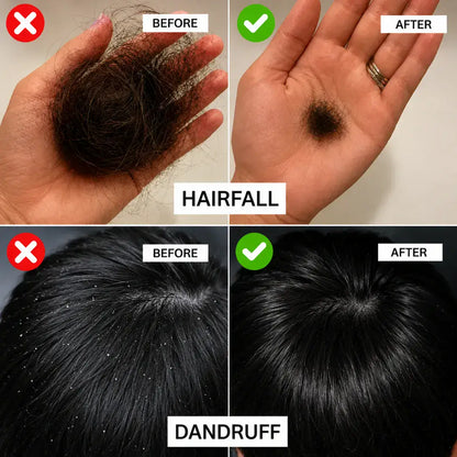 Lysora Ayurvedic Herbal Hair Oil | Hair Fall Control & Hair Regrowth Oil